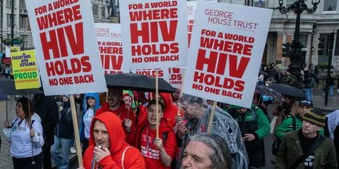 hiv/aids